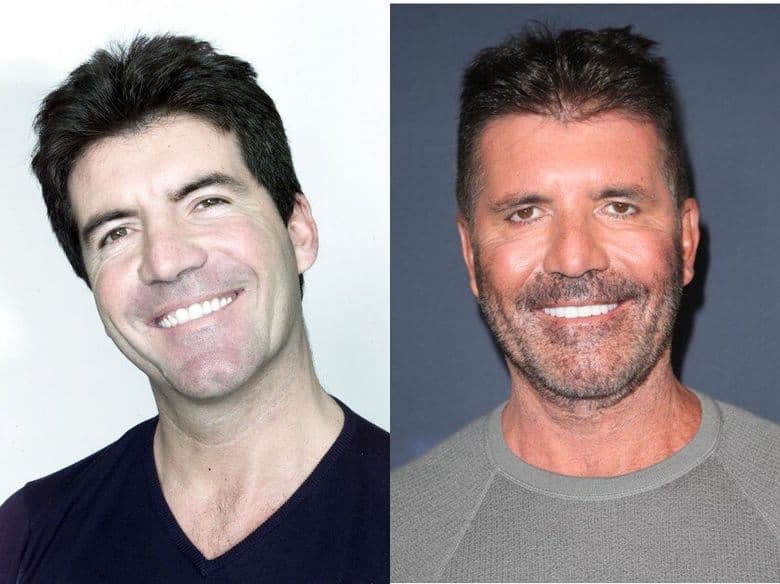 Celebrities: What's Happened to Your Face?